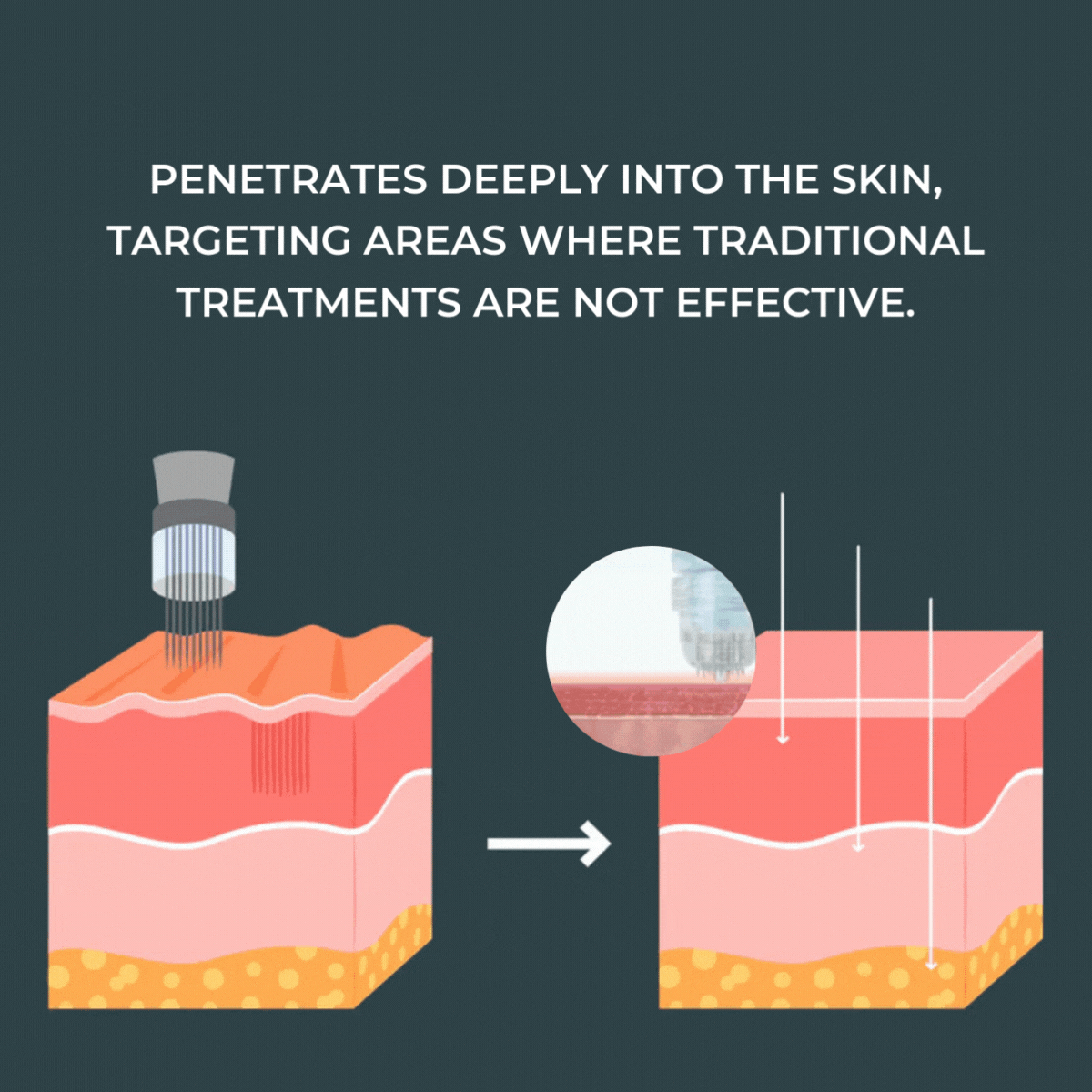 Micro-Infusion Anti-Aging Kit™